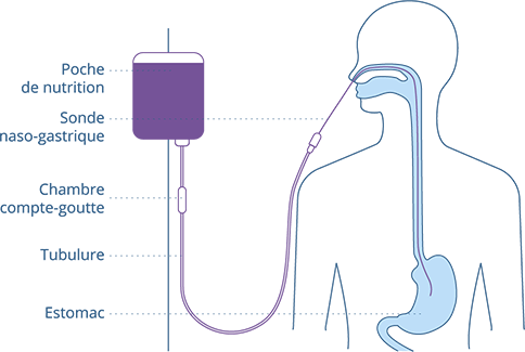 animation de la nutrition par gravité avec le liquide qui de vide dans l'estomac